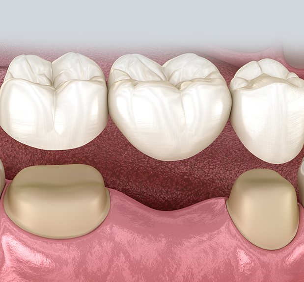 Treatment - The Holland Park Dentist