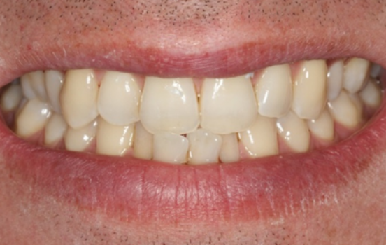 Before - The Holland Park Dentist