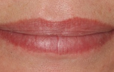 Before - The Holland Park Dentist