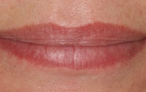 Before - The Holland Park Dentist